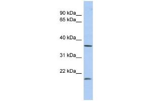 MTHFD2L antibody used at 1 ug/ml to detect target protein. (MTHFD2L Antikörper)