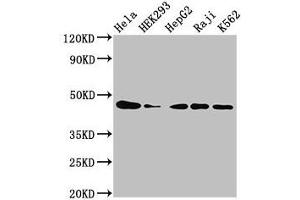 Western Blot Positive WB detected in: Hela whole cell lysate, HEK293 whole cell lysate, HepG2 whole cell lysate, Raji whole cell lysate, K562 whole cell lysate All lanes: CSNK2A1 antibody at 3 μg/mL Secondary Goat polyclonal to rabbit IgG at 1/50000 dilution Predicted band size: 46, 30 kDa Observed band size: 46 kDa