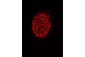 Histone H4 acetyl Lys5 antibody tested by immunofluorescence. (Histone H4 Antikörper  (acLys5))