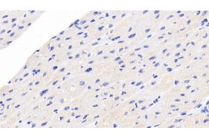 Detection of NT-ProBNP in Human Cardiac Muscle Tissue using Monoclonal Antibody to N-Terminal Pro-Brain Natriuretic Peptide (NT-ProBNP) (NT-ProBNP Antikörper  (AA 27-102))