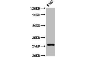 Western Blot Positive WB detected in:K562 whole cell lysate All lanes:CD81 antibody at 1. (Rekombinanter CD81 Antikörper)