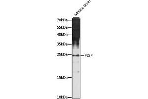 Western blot analysis of extracts of mouse brain, using PIGP antibody (ABIN6292034) at 1:1000 dilution. (PIGP Antikörper)