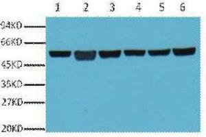 Western Blot (WB) analysis of A549 (1), Rat Brain (2), Mouse Brain (3), Chicken lung (4) and Rabbit testis (5), Sheep muscle (6), diluted at 1:5000. (TUBB Antikörper)
