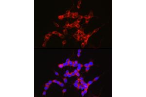 Immunofluorescence analysis of SH-SY5Y cells using NPY5R Rabbit mAb (ABIN7268890) at dilution of 1:100 (40x lens). (NPY5R Antikörper)