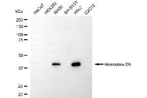 Western blotting analysis using homeobox D9 antibody (ABIN7798995).