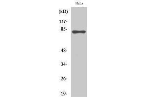 Western Blotting (WB) image for anti-RAD17 (RAD17) (pSer645) antibody (ABIN3182190) (RAD17 Antikörper  (pSer645))