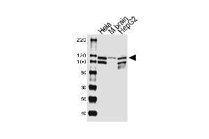 Western blot analysis of lysates from Hela cell line, mouse brain tissue lysate, HepG2 cell line (from left to right), using UBE3CAntibody (Center) (ABIN1881969 and ABIN2843383). (UBE3C Antikörper  (AA 549-578))