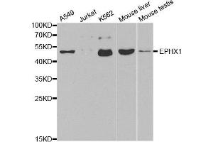 Western blot analysis of extracts of various cell lines, using EPHX1 antibody. (EPHX1 Antikörper)