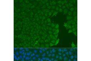 Immunofluorescence analysis of U2OS cells using CD31 Polyclonal Antibody at dilution of 1:100. (CD31 Antikörper)