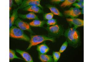 HeLa cell cultures stained with ABIN1580461 (green) and ’s chicken polyclonal antibody to vimentin: CPCA-Vim (red).