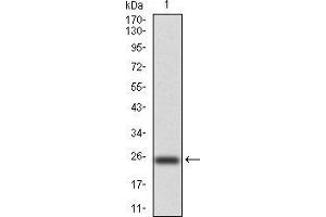 Western blot analysis using NOX4 mAb against human NOX4 (AA: 210-310) recombinant protein. (NADPH Oxidase 4 Antikörper  (AA 210-310))