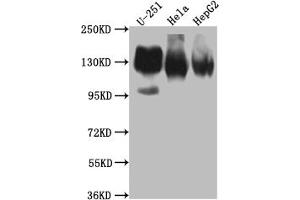 Western Blot Positive WB detected in: U-251 whole cell lysate, Hela whole cell lysate, HepG2 whole cell lysate All lanes: ITGAV antibody at 1:1000 Secondary Goat polyclonal to rabbit IgG at 1/50000 dilution Predicted band size: 117, 113, 112 kDa Observed band size: 130 kDa (Rekombinanter CD51 Antikörper)