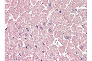 Human Heart (formalin-fixed, paraffin-embedded) stained with ARHGEF17 antibody LAP22665PU-N at 5 µg/ml followed by biotinylated goat anti-rabbit IgG secondary antibody, alkaline phosphatase-streptavidin and chromogen. (ARHGEF17 Antikörper)