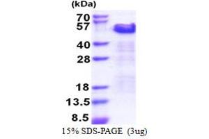 SDS-PAGE (SDS) image for Thyroid Hormone Receptor Interactor 10 (TRIP10) (AA 260-545) protein (His tag) (ABIN5853438)