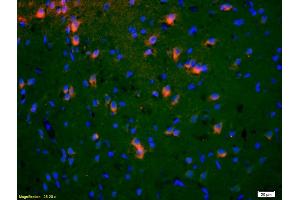 Formalin-fixed and paraffin-embedded rat brain labeled with Anti-EphA5/Eph receptor A5 Polyclonal Antibody, Unconjugated (ABIN718661) 1:200, overnight at 4°C, The secondary antibody was Goat Anti-Rabbit IgG, Cy3 conjugated used at 1:200 dilution for 40 minutes at 37°C. (EPH Receptor A5 Antikörper  (AA 451-550))