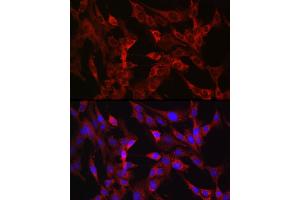 Immunofluorescence analysis of C6 cells using TMPRSS2 Rabbit pAb (ABIN6132728, ABIN6149286, ABIN6149287 and ABIN6219138) at dilution of 1:50 (40x lens).