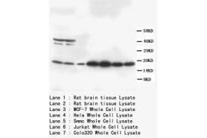 Image no. 1 for anti-S100 Calcium Binding Protein B (S100B) (C-Term) antibody (ABIN1493108) (S100B Antikörper  (C-Term))