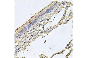 Immunohistochemistry of paraffin-embedded human trachea using FABP12 antibody (ABIN6003626) at dilution of 1/100 (40x lens). (FABP12 Antikörper)