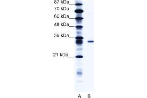 WB Suggested Anti-KCNIP4 Antibody   Titration: 1. (KCNIP4 Antikörper  (N-Term))