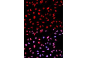 Immunofluorescence analysis of MCF7 cell using Phospho-Dnmt1-pS714 antibody. (DNMT1 Antikörper  (pSer714))