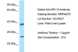 Western Blotting (WB) image for anti-Ribosomal Protein L10 (RPL10) (N-Term) antibody (ABIN2789820) (RPL10 Antikörper  (N-Term))