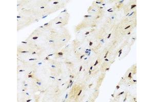 Immunohistochemistry of paraffin-embedded Mouse heart using ZBTB17 Polyclonal Antibody at dilution of 1:100 (40x lens). (ZBTB17 Antikörper)