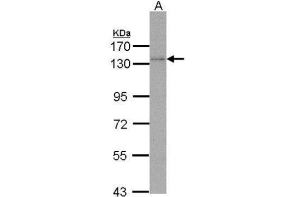 POLD1 antibody  (Center)