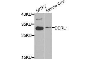 Western blot analysis of extracts of MCF7 and mouse liver cells, using DERL1 antibody. (DERL1 Antikörper)