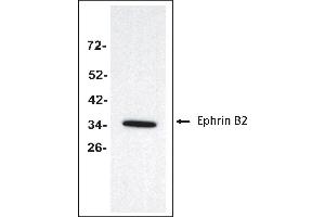 Antigen: Colo 205 cells lysate (Total protein per lane: 20 µg)  Primary Antibody: Anti-EFNB2 monoclonal (PA349-18. (Ephrin B2 Antikörper  (Extracellular Domain))
