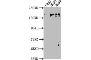 Western Blot Positive WB detected in: U251 whole cell lysate, HL60 whole cell lysate, 293T whole cell lysate All lanes: ADNP antibody at 1:2000 Secondary Goat polyclonal to rabbit IgG at 1/50000 dilution Predicted band size: 124 kDa Observed band size: 135 kDa (ADNP Antikörper  (AA 867-1102))