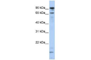 WB Suggested Anti-MSL2L1 Antibody Titration:  0. (MSL2 Antikörper  (N-Term))