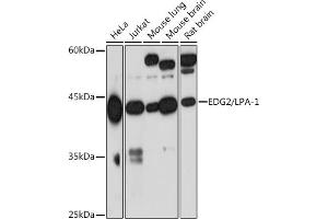 Western blot analysis of extracts of various cell lines, using EDG2/LPA-1 Rabbit mAb (ABIN7268334) at 1:1000 dilution. (LPAR1 Antikörper)