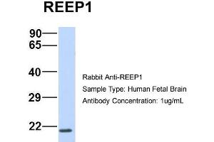 Host:  Rabbit  Target Name:  REEP1  Sample Type:  Human Fetal Brain  Antibody Dilution:  1.