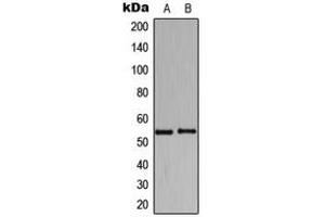 Western blot analysis of HARS expression in K562 (A), Raw264. (HARS1/Jo-1 Antikörper  (C-Term))