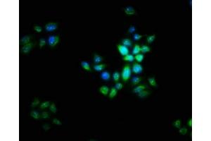 Immunofluorescence staining of PC-3 cells with ABIN7165742 at 1:16, counter-stained with DAPI.