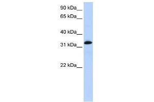 WB Suggested Anti-TNNT2 Antibody Titration:  0.