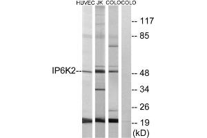 Western Blotting (WB) image for anti-Inositol Hexakisphosphate Kinase 2 (IP6K2) (Internal Region) antibody (ABIN1850059) (IP6K2 Antikörper  (Internal Region))