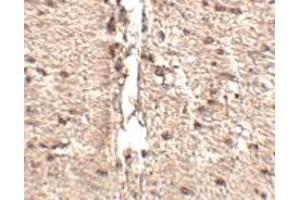 Immunohistochemistry of MEX3D in human small intestine tissue with MEX3D polyclonal antibody  at 2.