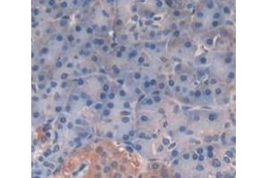 IHC-P analysis of Human Tissue, with DAB staining. (TPSG1 Antikörper  (AA 99-244))