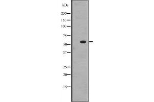Western blot analysis of ZNF71 expression in A431 whole cell lysate ,The lane on the left is treated with the antigen-specific peptide. (ZNF71 Antikörper)
