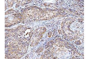 IHC analysis of Integrin linked ILK using anti-Integrin linked ILK antibody (ABIN7602632).