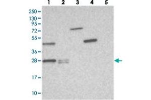 Western blot analysis of Lane 1: RT-4, Lane 2: U-251 MG, Lane 3: Human Plasma, Lane 4: Liver, Lane 5: Tonsil with THYN1 polyclonal antibody  at 1:250-1:500 dilution.