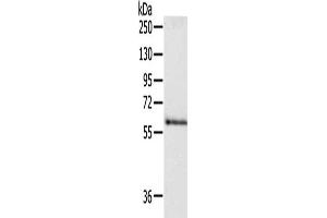 Gel: 8 % SDS-PAGE, Lysate: 40 μg, Lane: Human fetal brain tissue, Primary antibody: ABIN7190498(DPYSL5 Antibody) at dilution 1/250, Secondary antibody: Goat anti rabbit IgG at 1/8000 dilution, Exposure time: 30 seconds (DPYSL5 Antikörper)