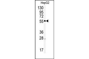 Image no. 1 for anti-Hepatocyte Nuclear Factor 4, alpha (HNF4A) (Middle Region) antibody (ABIN357941) (HNF4A Antikörper  (Middle Region))