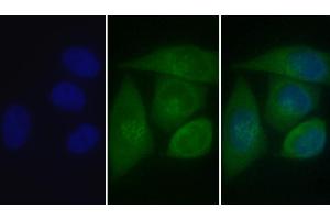 Detection of CALR in Human MCF7 cell using Polyclonal Antibody to Calreticulin (CALR) (Calreticulin Antikörper  (AA 18-193))
