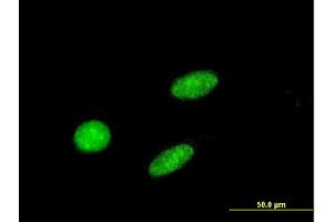 Immunofluorescence of monoclonal antibody to GCM1 on HeLa cell.