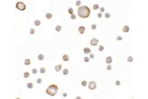 Immunocytochemical staining of MCF-7 cells with KAL1 polyclonal antibody  at 5 ug/mL. (KAL1 Antikörper  (Internal Region))