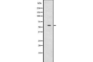 Western blot analysis of UGT2B using HepG2 whole  lysates. (UGT2B17 Antikörper  (N-Term))