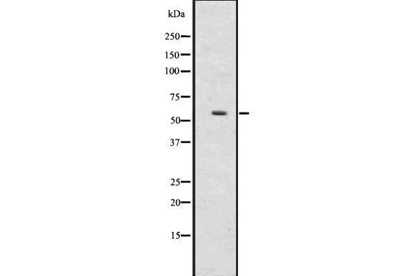 UGT2B17 Antikörper  (N-Term)