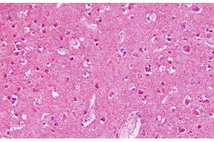 Anti-MGLUR2 / GLUR2 antibody IHC staining of human brain, cortex. (GRM2 Antikörper  (N-Term))